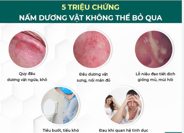 Hình ảnh minh họa